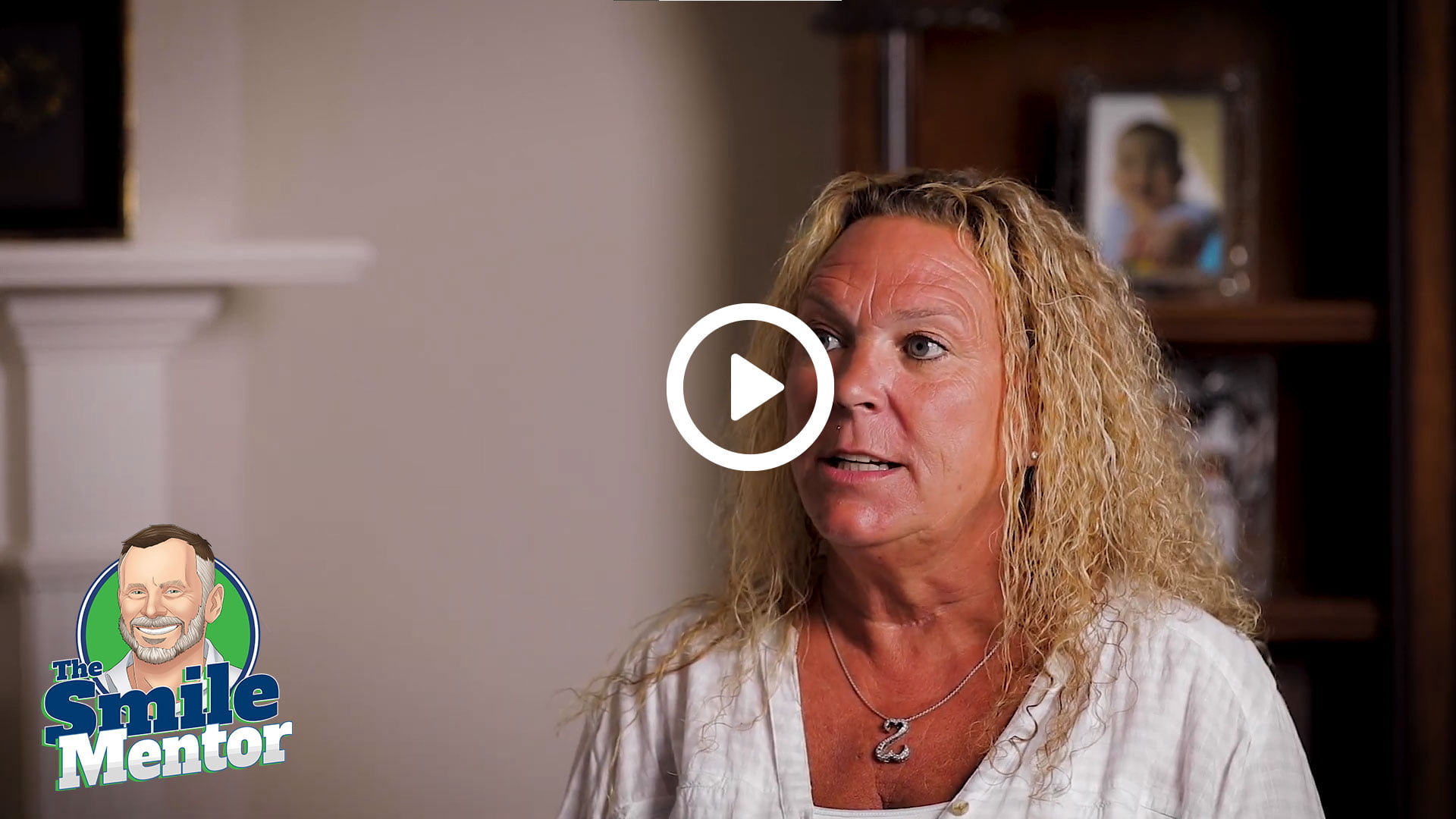 Jen: Life with An Implant Supported-Arch jen shares life with an implant supported arch v3